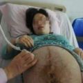 四胞胎孕媽38周遲遲不生，婆婆跪求阻止手術，剖開肚子醫生被嚇暈