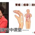 刮痧治療突發病、急症（下）｜中醫家空中課堂