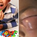 泰3歲男童「懶惰刷牙」下場超慘　牙醫PO照：牙齒全蛀、菌跑去眼睛