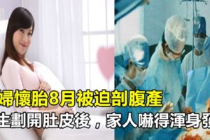 孕婦懷胎8月被迫剖腹產，醫生劃開肚皮後，家人嚇得渾身發抖