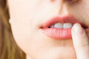 嘴唇總愛起皮是為什麼？背後這4個「兇手」，你該管管了