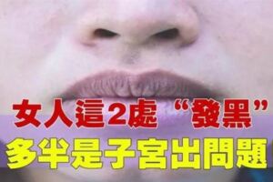 女人身上這2處「發黑」，多半是子宮出問題，做好這4點，宮寒不上身