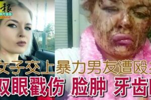 悲！女子交上暴力男友遭毆打雙眼戳傷臉腫牙齒斷！身心靈遭折磨傷害！