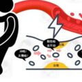 血管有「垃圾」？醫生揭示：養生界4大謊言