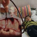 8歲男孩用自己的骨髓救白血病父親「為了救爸爸我什麼都不怕」！