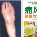 痛風病人可以吃哪些食物？近幾年來痛風病發病率較高，尤其是中老年人男性最多見