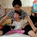 連生3娃同患腦癱，兒子不幸溺亡，「狠心」媽媽壓腿幫兩女兒康復