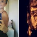 20周胎兒「拿出來醫好又放回去」　媽媽忍淚笑：證明女兒值得活下來