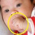 6個月寶寶握緊拳頭不放，奶奶發現不對送醫檢查，醫生：已經晚了。