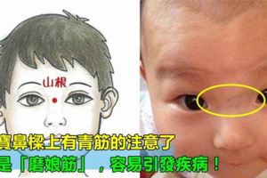 寶寶鼻樑上有青筋的注意了，這是「磨娘筋」，容易引發這些疾病！