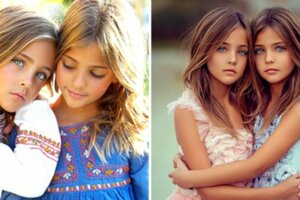 「世界最美雙胞胎」8歲就有百萬粉絲　網看到爸媽驚：這基因注定生出天使！