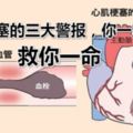 梗塞）心肌梗塞的三大警報，你一定要知道高血壓性心髒病、冠狀動脈心髒病（心絞痛、心肌