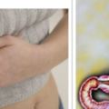 胃炎到胃癌僅4步這樣做阻斷癌變！