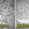 9種透過顯微鏡拍下因各種情緒流下的眼淚結晶