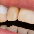 有多少國人在假刷牙？6個誤區還繼續犯，牙齒遲早被你刷壞