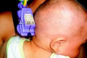 18個月大的寶寶被玩具插入後腦，醫生稱贊媽媽做的太英明！
