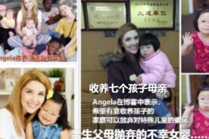 被自己的親生父母拋棄的不幸女嬰……患有唐氏綜合症，卻成了美國小網紅！