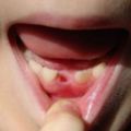 醫生們呼籲父母「小孩乳牙掉落千萬不要丟掉」，一直都把乳牙丟掉的父母現在超後悔啊！