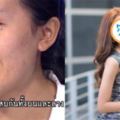 泰國整容真人秀醜女哭訴只想變正常人，改造完變「混血感天菜正妹」網友驚呆！