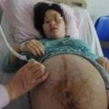 四胞胎孕媽38周遲遲不生，婆婆跪求阻止手術，剖開肚子醫生絕望搖頭！