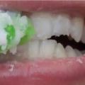牙膏上加它無需洗牙，1個月後神奇的一幕發生了！