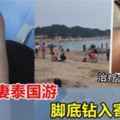 沙灘赤腳要當心！新婚夫妻泰國游，腳底遭寄生蟲鑽入，治療方法很恐怖~