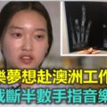 韓女赴澳洲工作假期慘遭截斷半數手指音樂夢碎