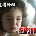 7歲女童遇蜂群狂螫300下休克送醫急救保一命