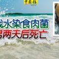 海灘戲水染食肉菌66歲男兩天後死亡