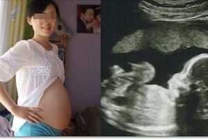 他聽見孕妻的肚子「傳來胎兒笑聲」嚇得兩眼發直！醫生一聽嚇壞：「胎兒可能不保了...」