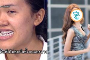 泰國整容真人秀醜女哭訴只想變正常人，改造完變「混血感天菜正妹」網友驚呆！