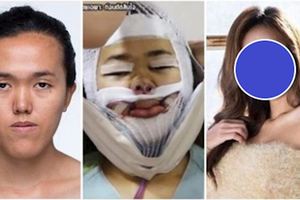 戽斗妹痛哭：「我想有一張正常人的臉！」節目砸錢讓她圓夢「整完變混血美女」根本仙女下凡！