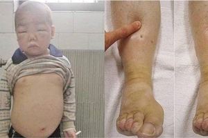 孩子給奶奶突然帶成了一大胖子，醫生的話讓兒子一氣之下扇她耳光！