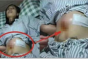23歲女生腹大如球，一上救護車，醫生就說「不用救了」！女人都要小心…