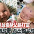 到壘球場替父親打氣女嬰遭球擊腦出血命危