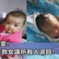 偉大的母愛！孩子，媽媽和妳「同肝」共苦，媽媽割肝救女讓所有人淚目！