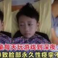 6歲男童每天玩遊戲到深夜，導致臉部永久性痙攣不停眨眼！