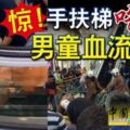 2019-04-28:沙登,驚！手扶梯「吃」腳6歲男童血流不止!!!(內附視頻）