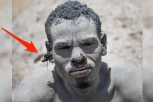 他們每天泡入會「腐蝕身體的水裡」，手腳「漸漸潰爛」眼睛幾乎全盲就只為了...