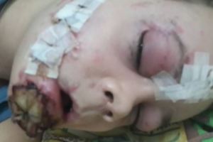 11歲小男孩找到「又黑又大的東西」便拿起來跟朋友炫耀，但一聲巨響後…母親看到的是他被「絞碎」的身體。