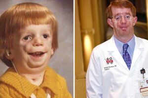 「外貌異常」的男孩靠自己逆轉人生　長大成為兒科醫生驕傲活著