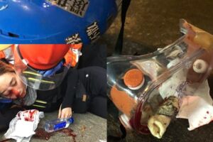 港女義士眼睛被射爆 反送中號召百萬人塞爆機場