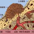 日本人靠着「喝白開水」就能預防癌細胞滋生，關鍵就在於一個簡單到不行的步驟！