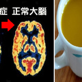 「失智」救星是它！每天兩杯降伏「阿茲海默症」、腦細胞全修復，這樣吃最有效