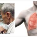 慢性阻塞性肺病（哮喘、支氣管擴張、充血性心衰、肺結核等）