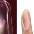 指甲發生的這4個變化，是肝髒的「求救信號」，小心拖成肝癌！