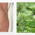 膝蓋疼痛，是不是得了滑膜炎？門前常見1植物，讓你遠離滑膜炎