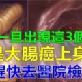 腫瘤專家的警告：大便出現這3個訊號，可是大腸癌！！！