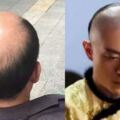「留髮不留頭，留頭不留髮」，清朝時期的人一律要留辮子，那禿頭和光頭的人該怎麼辦？