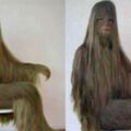 世界的體毛最長的人，全身長毛像猿人醫學無解，剃光後竟成美女！